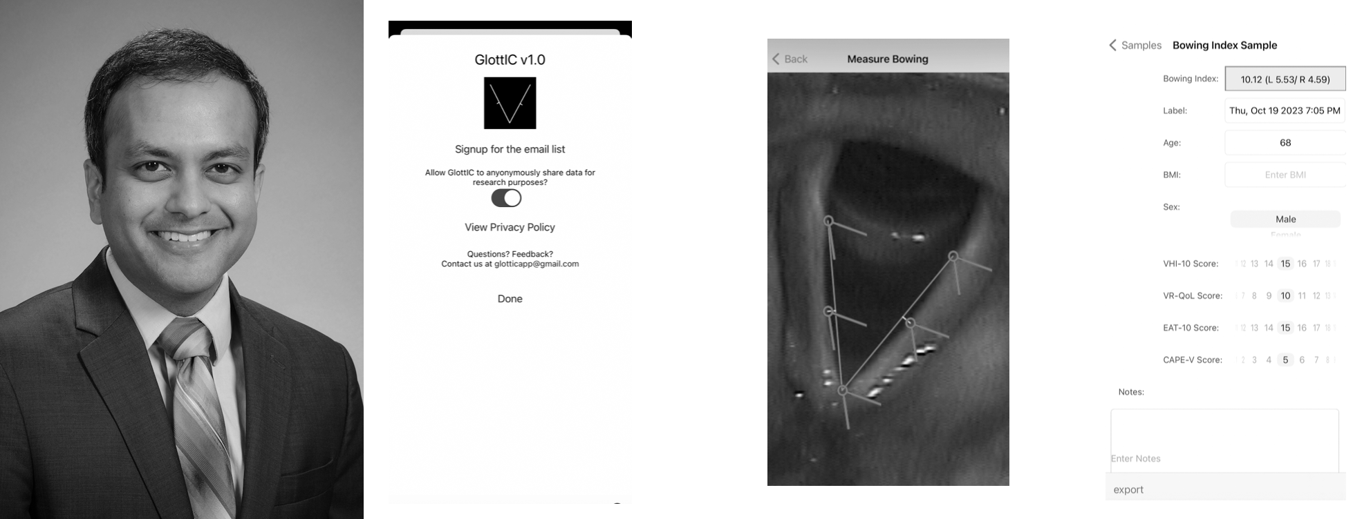 Neel Bhatt, MD, with GlottIC app screen shots