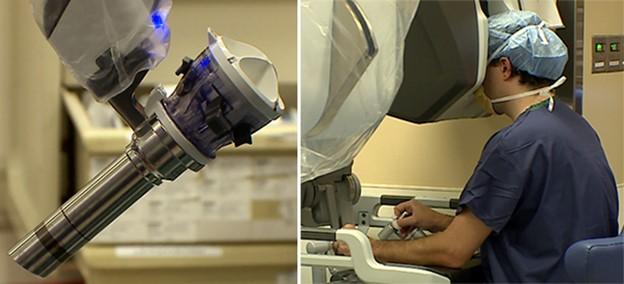 This is the image for Head and neck surgeons celebrate new robot entry